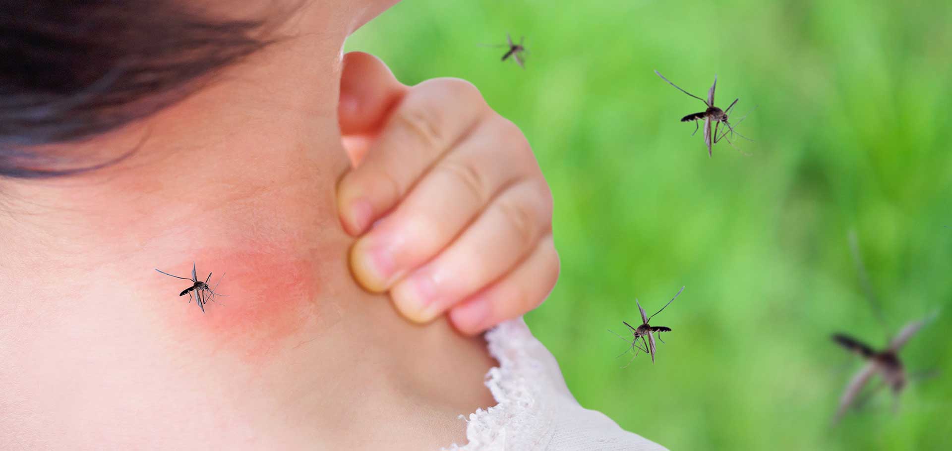 How do i keep mosquitos away from my home?